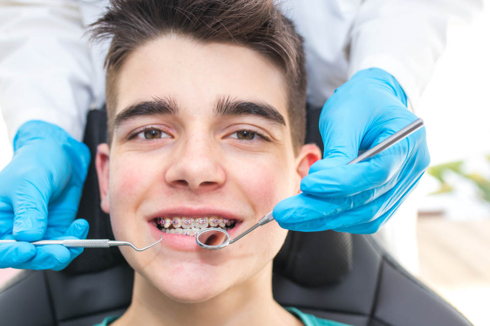 Boy with Braces (Facts About Orthodontic Treatments)