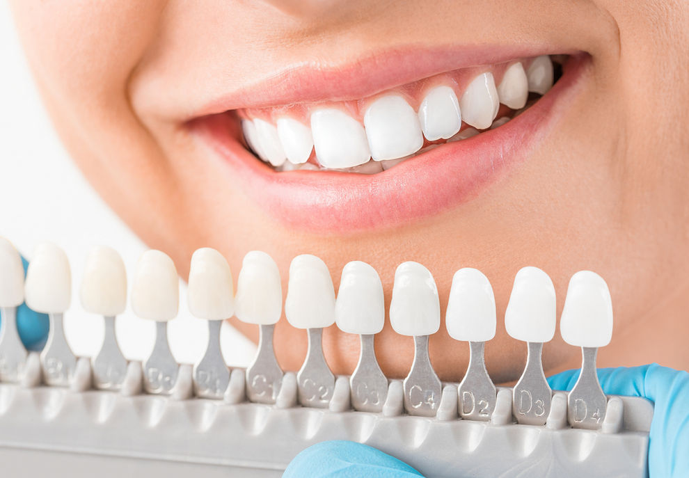 How Cosmetic Dental Care Can Improve Your Oral Health