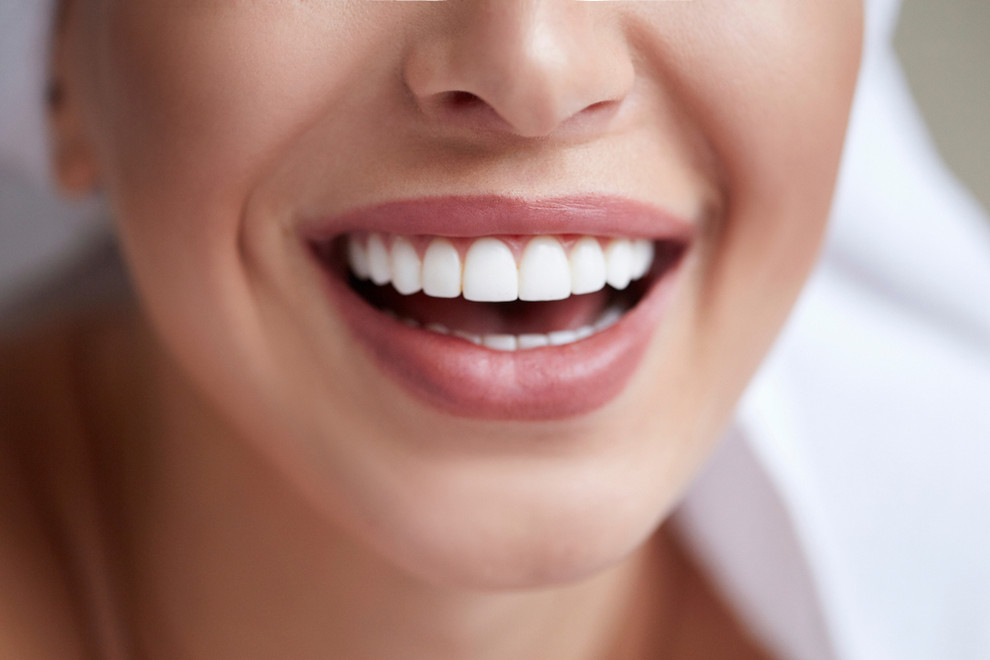 Lumineers vs. Dental Veneers